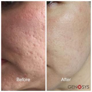 before and after treatment before and after treatment