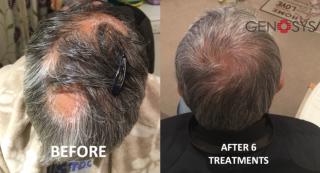 after 6 treatments after 6 treatments