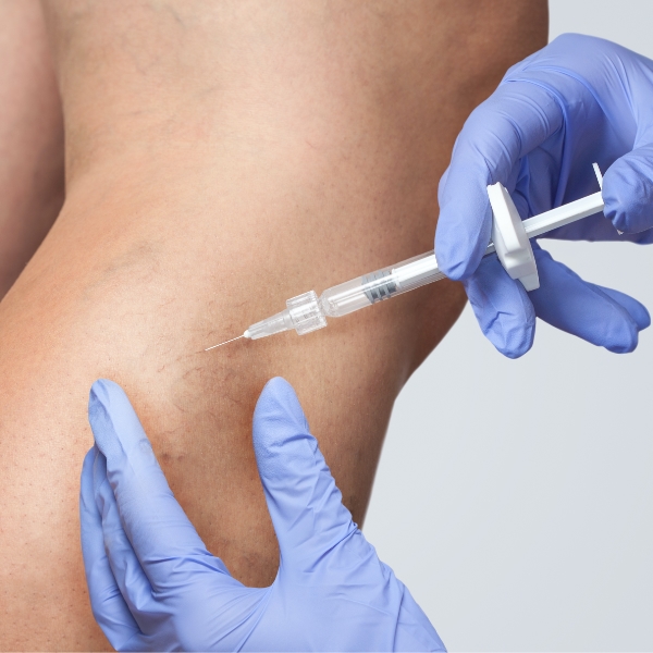 Micro Sclerotherapy