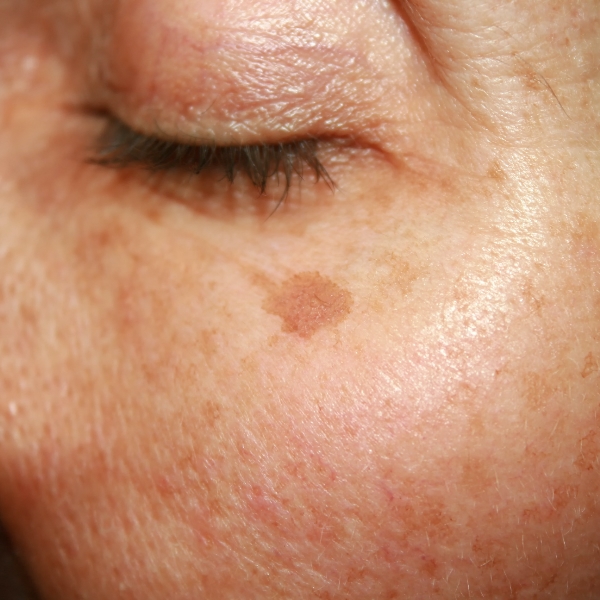 condition image