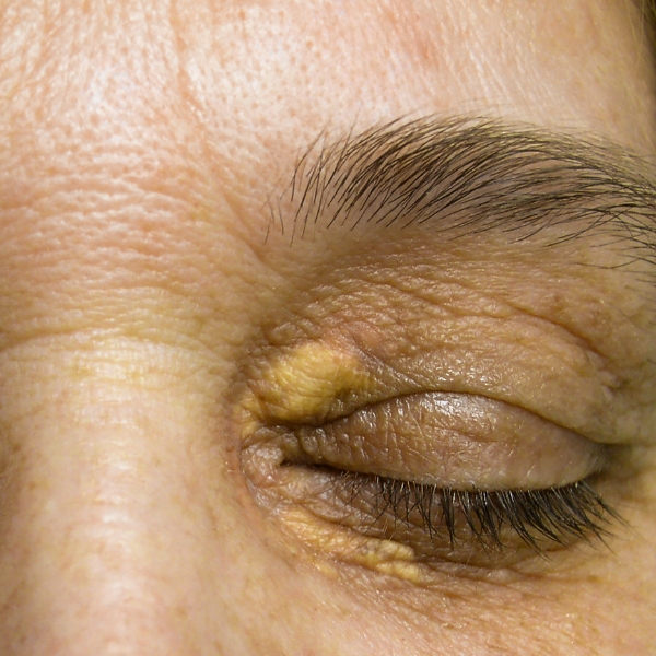 condition image