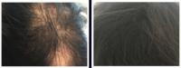 thumb image